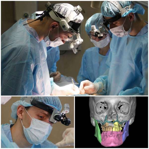 В Преображенской Клинике выполнена уникальная операция по исправлению зубо-челюстной аномалии у пациентки с врождённой расщелиной губы и твёрдого нёба