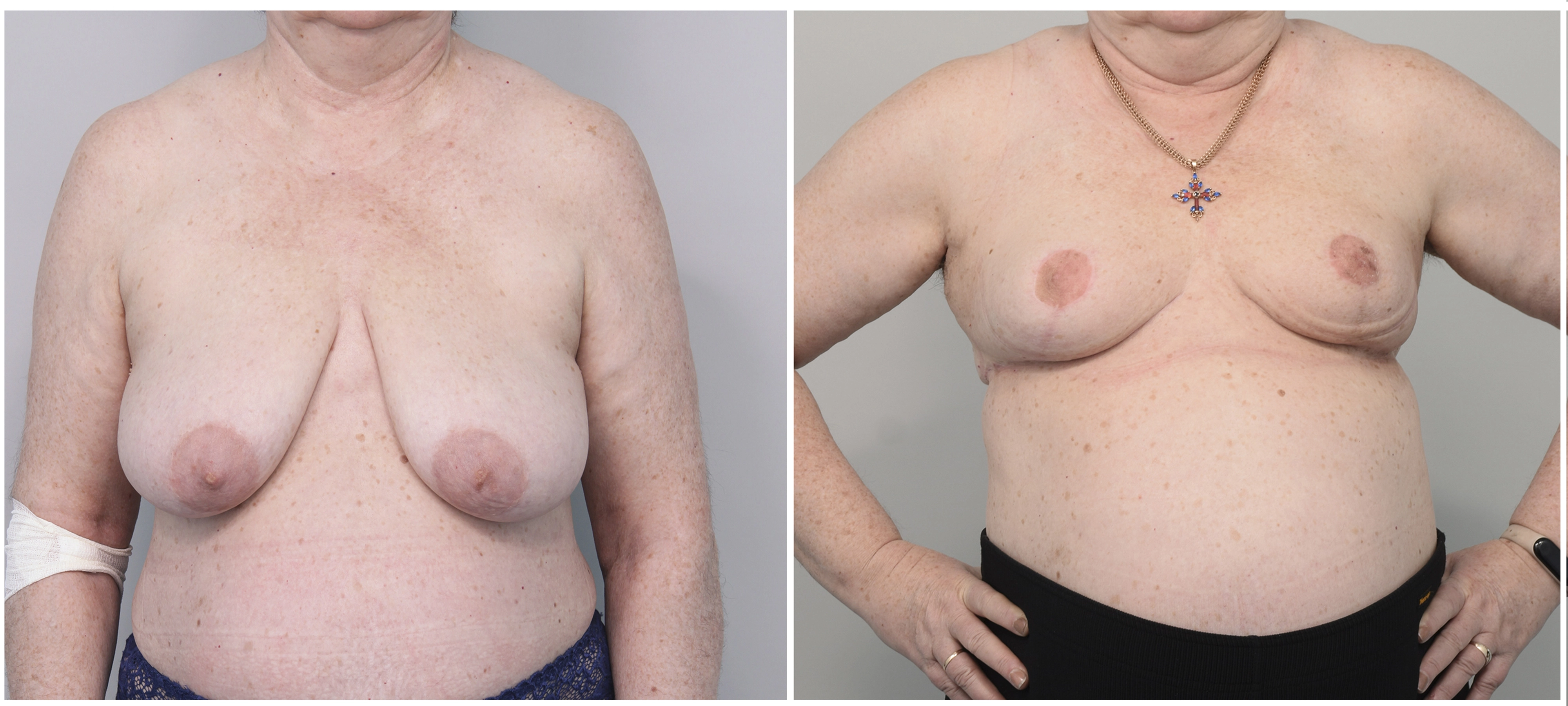 жжение в левой груди у женщин что означает фото 106